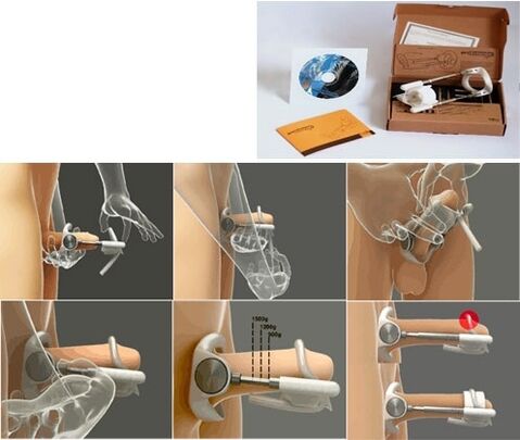Tăng kích thước dương vật bằng dụng cụ kéo dài
